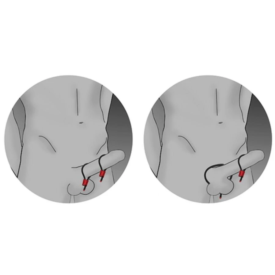 ESD-243689A11X